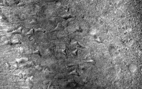 Entorhinal Cortex Slice from 9 month-old Rat