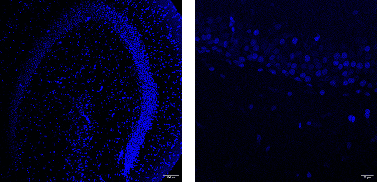 DAPI-stained 350µm hippocampal slices taken from a male Wistar rat of approximately 2 months old.