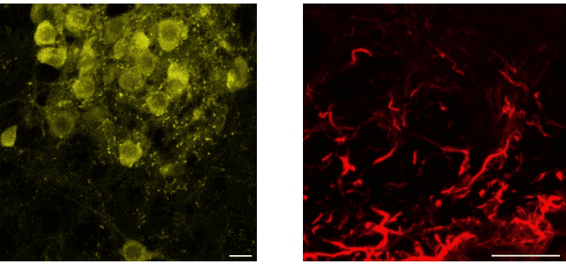brainstem slice brainstem slice