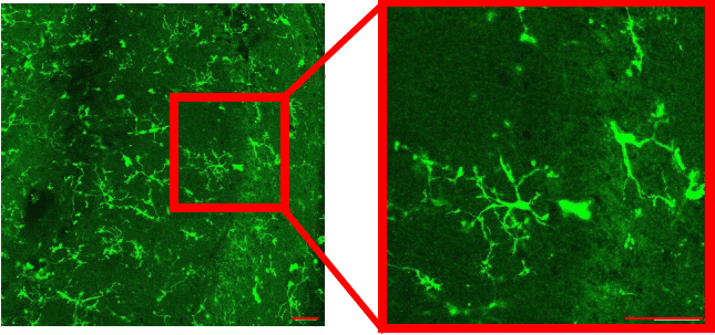 hippocampus slice hippocampus slice