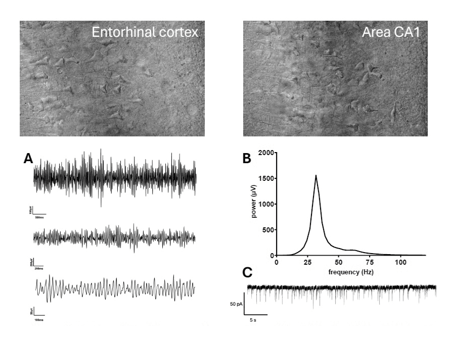oscillations slices 9-month old rats oscillations slices 9-month old rats